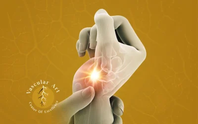 علاج تورم اليدين والقدمين